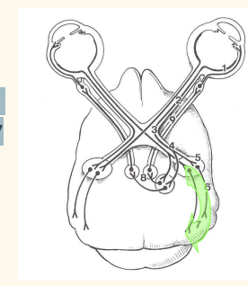 <p>Blindness with<strong> intact PLRs</strong> Differential diagnoses (more central)</p>