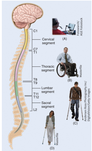 <p>location of the injury:</p><p>A – no function from the neck down</p><p>B – some arm and chest muscle control</p><p>C – most thigh muscles</p><p>D – most leg muscles</p>