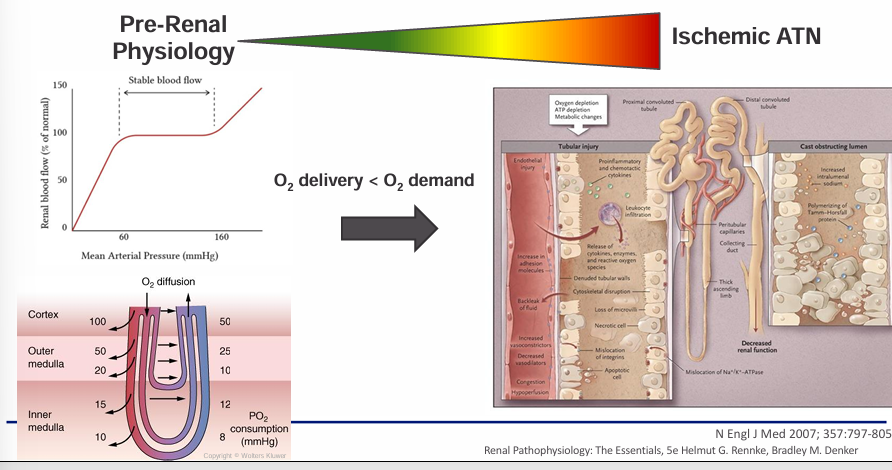 <p>-any insult that is severe enough or persists for long enough can overwhelm the kidney’s ability to autoregulate blood flow and consequently O2 delivery</p><p>-in other words, any insult can transform from simply pre-renal physiology into acute tubular necrosis (ATN)</p>