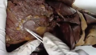 <p>Sac like structure under liver</p>