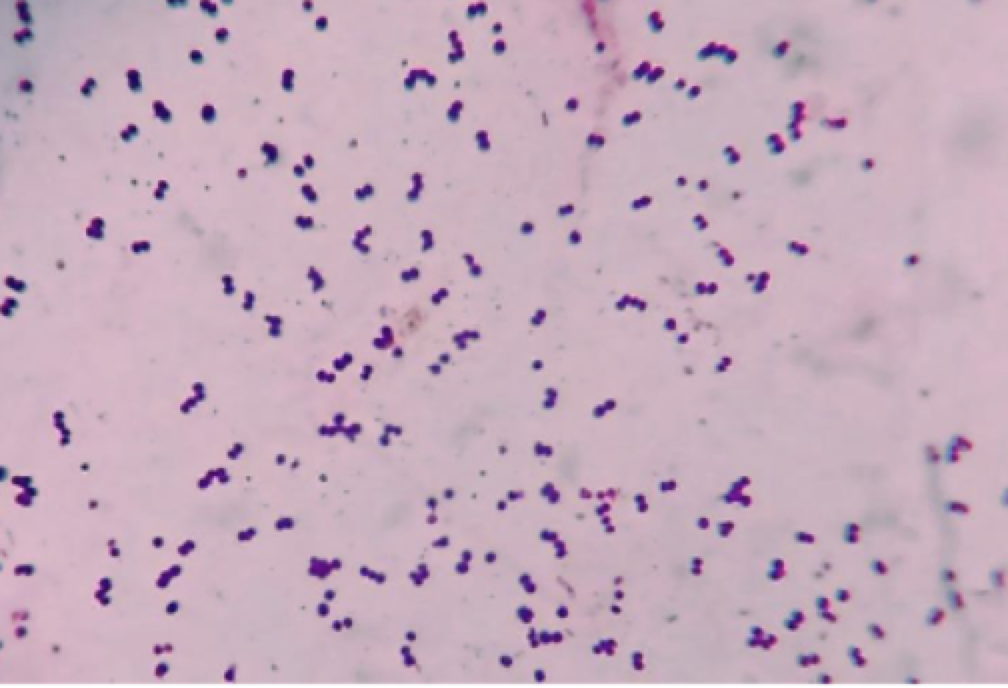 <p>What stain and what does it say about the bacteria?</p>