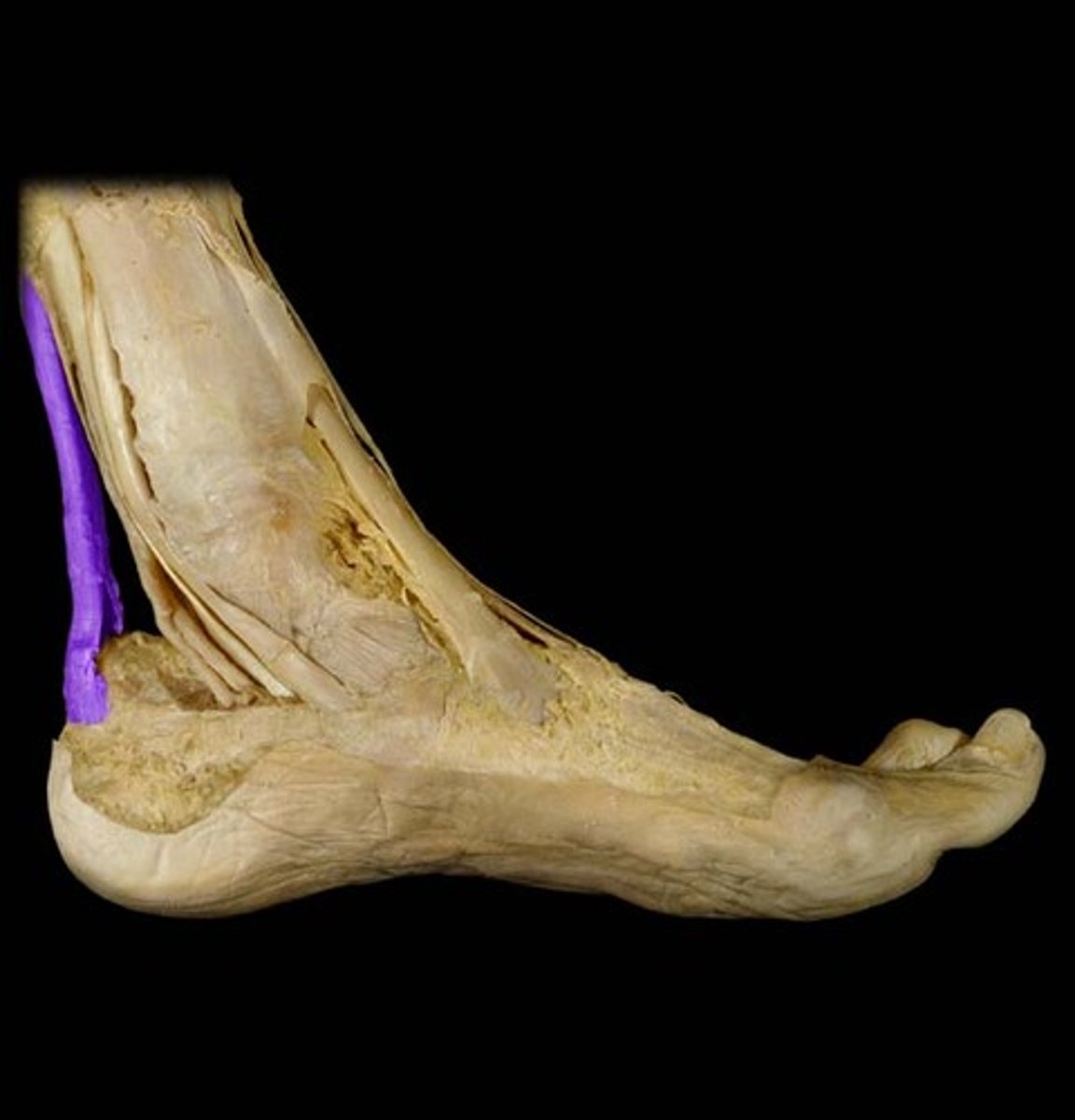 <p>Extends from the calf muscles to the calcaneus, plantarflexes the foot and limits dorsiflexion.</p>