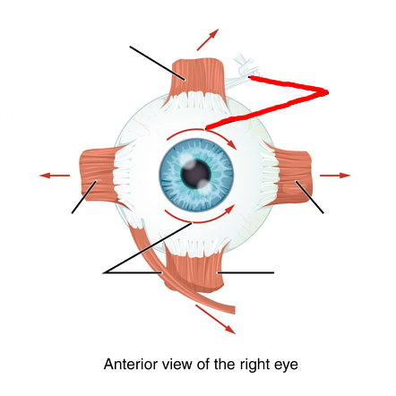 <p><u>Extrinsic muscles</u></p><p>Moves Eye Inferiorly and Laterally.</p><p>Cranial nerve IV (4).</p>