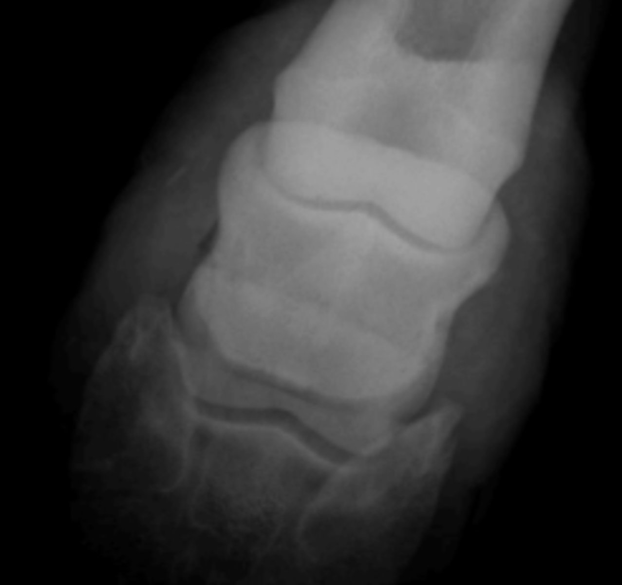 <p>Which shows the distal border of the navicular bone?</p>