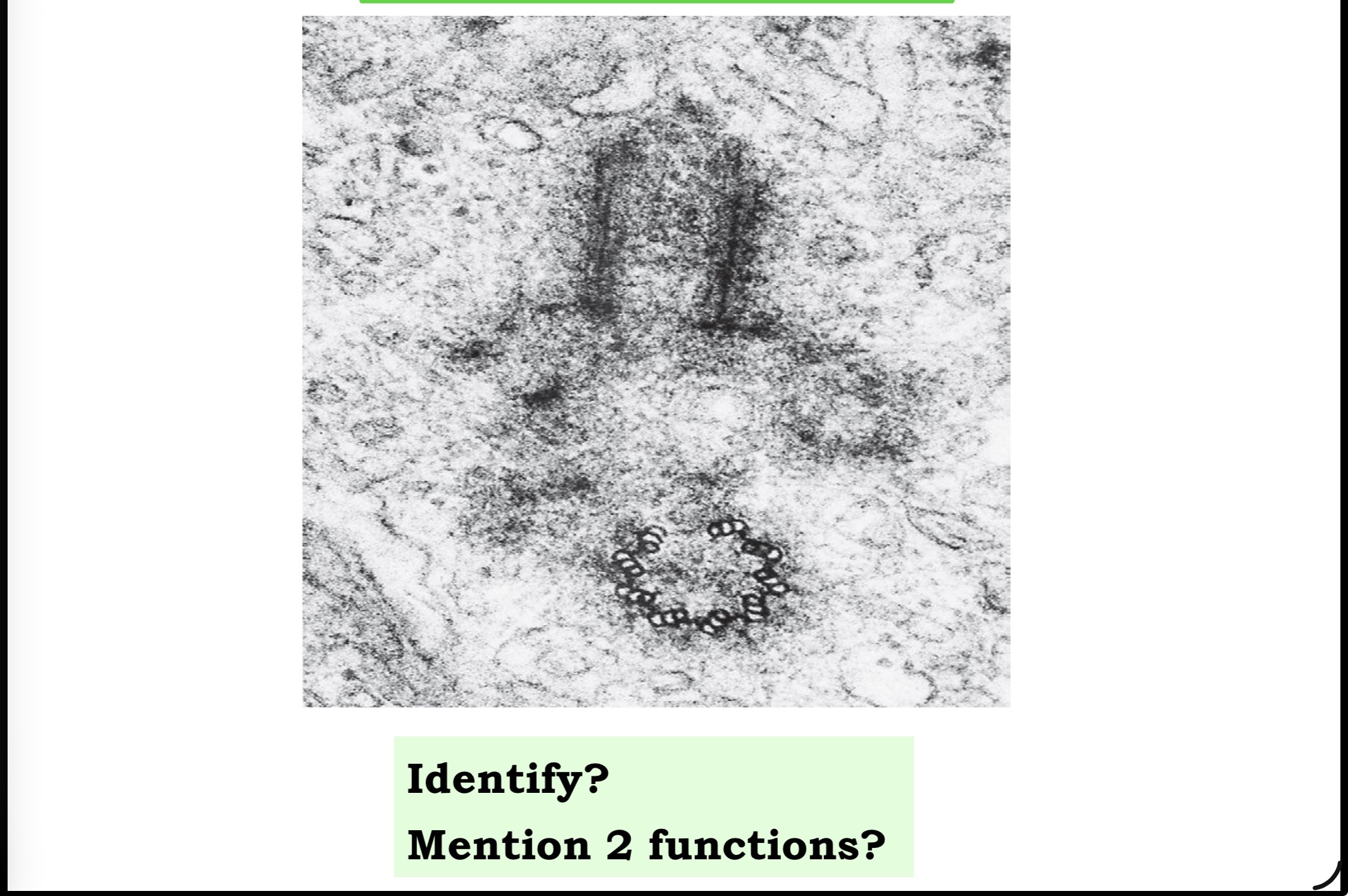 <p>Answer the questions in these following pictures</p>