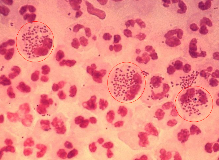 <p>What bacteria is this?</p>