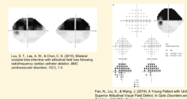 <p>> involves both quadrants of either the superior or inferior field </p><p></p><p></p><p></p>
