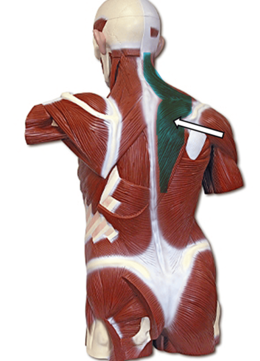 <p>name the muscle</p>
