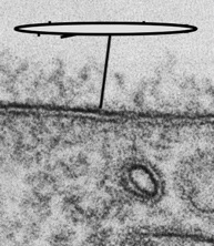 What structure is pointed at in the photo and what microscope was used?