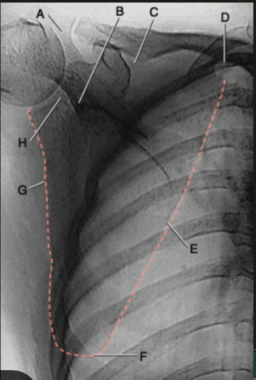 <p>E</p>