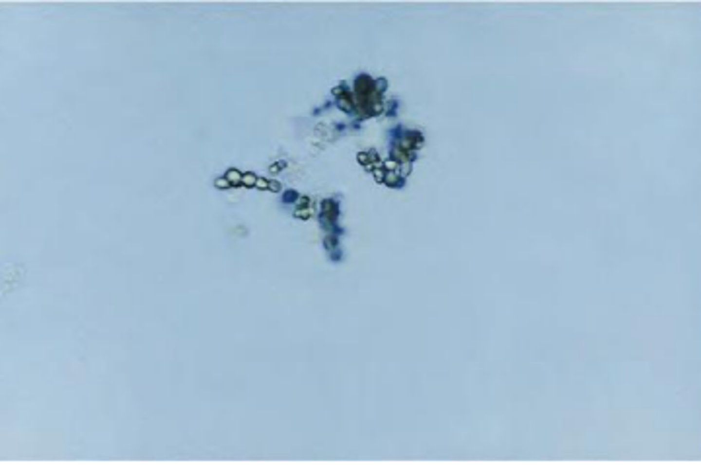 <p>- Small, dumbbell, and spherical shapes , colorless<br>- Gas produced with addition of acetic acid <br>- No clinical significance</p>