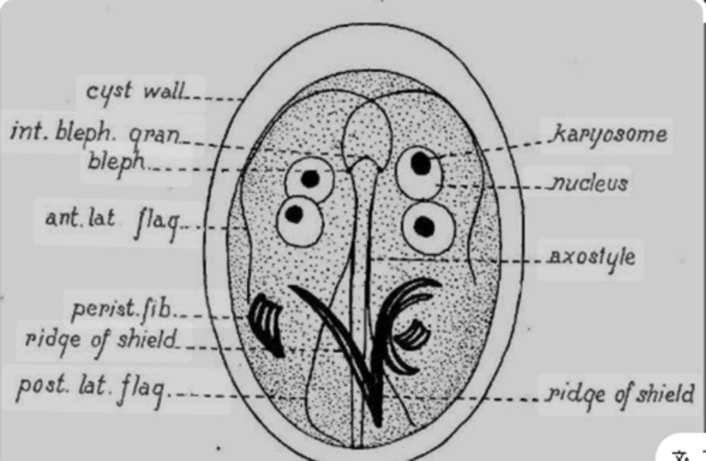 <p>Giardia cyst:<br>- Oval<br>- 4 nuclei<br>- 8-14 micrometer<br>- Feces<br>- thick, smooth wall<br>- Color: light brown/greenish (iodine or trichrome stains)</p>