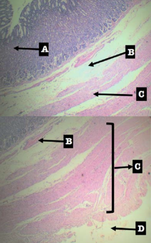 <p>Layers of Stomach:</p><p>A. Mucosa</p><p>B. Submucosa</p><p>C. Tunica muscularis</p><p>D. Tunica serosa</p>