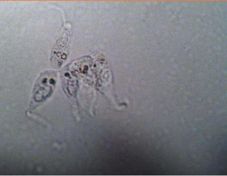 <p>These cells are present on sediment evaluation. What are they?</p>
