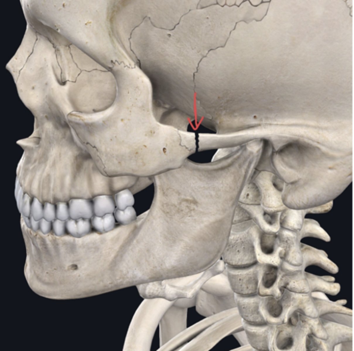 <p>Identify the plane of section in which the indicated fracture has occurred. (Free response)</p>