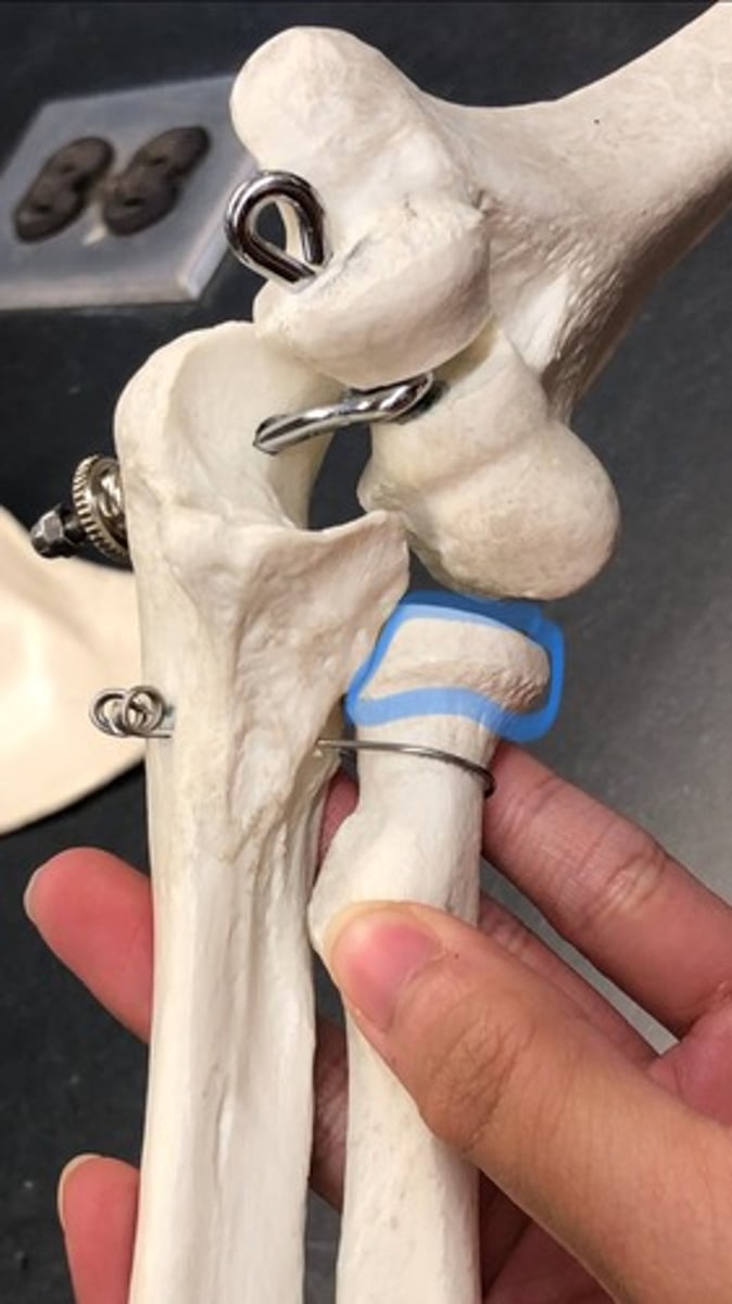 <p>knob on the top</p>