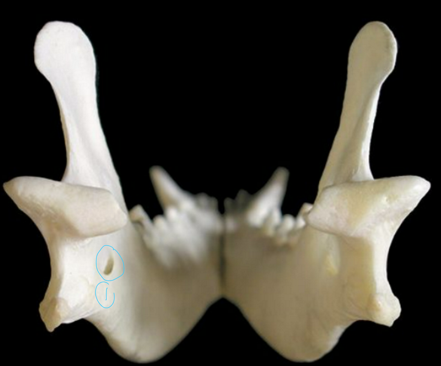 <p>label the caudal (back) view of the canine mandible</p>
