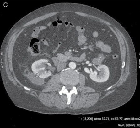 <p>Why is this ROI not appropriate?</p>