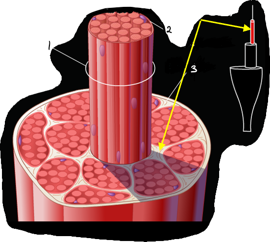 What is the web? What is the structure protruding out and what surrounds it?