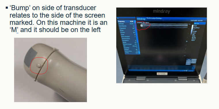 <ul><li><p>related to the side of the screen marked ‘M’</p></li><li><p>should be on the LEFT</p></li></ul><p></p>