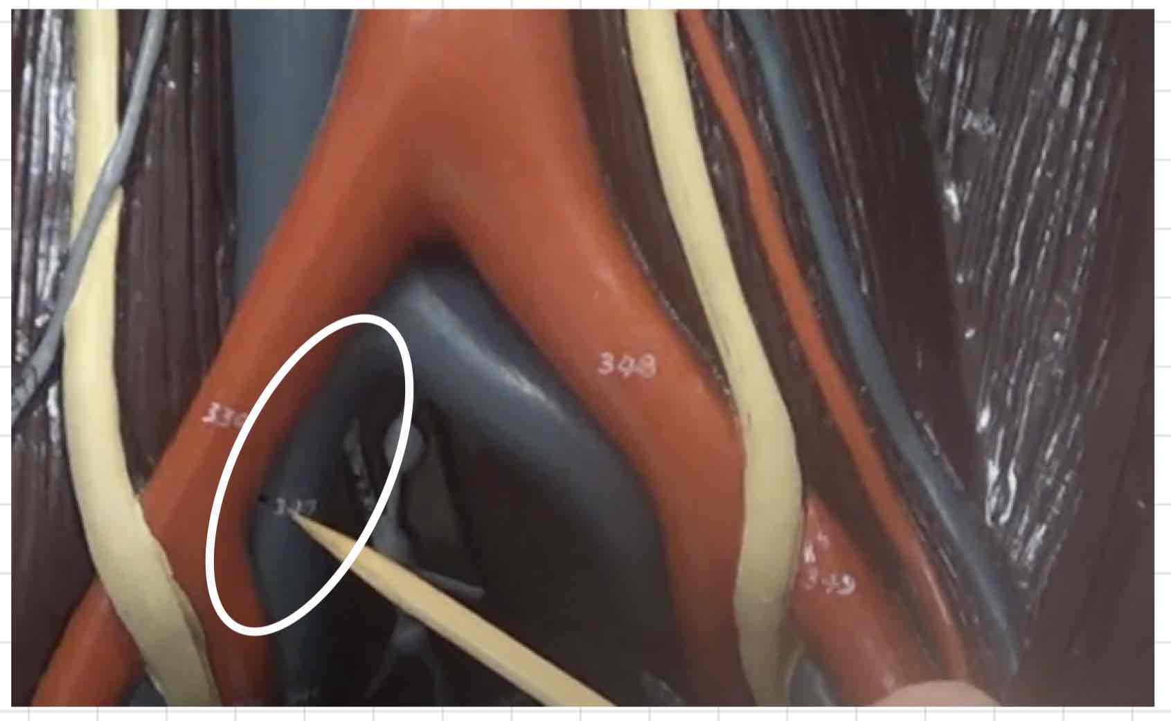 <p>what is this? (torso model)</p>