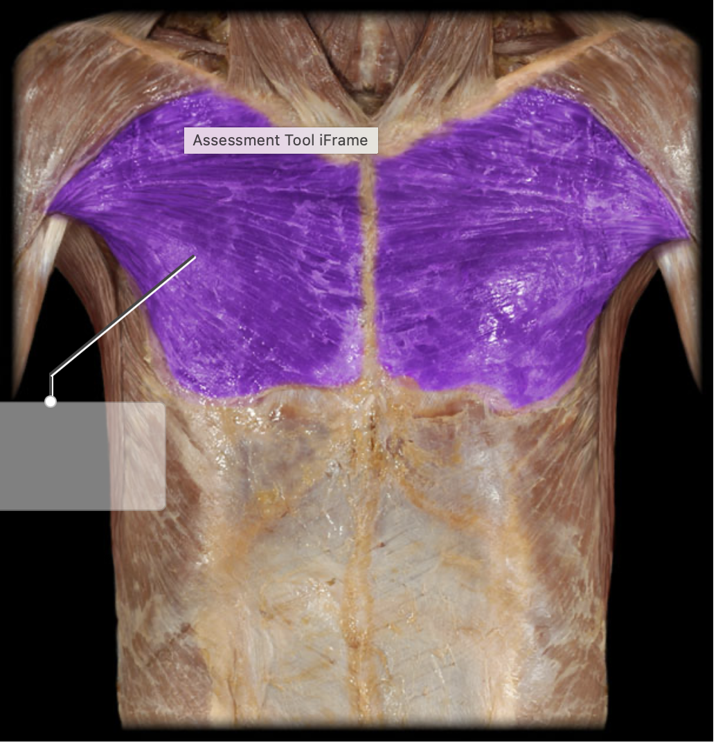 <p>Insertion of Pectoralis Major</p>