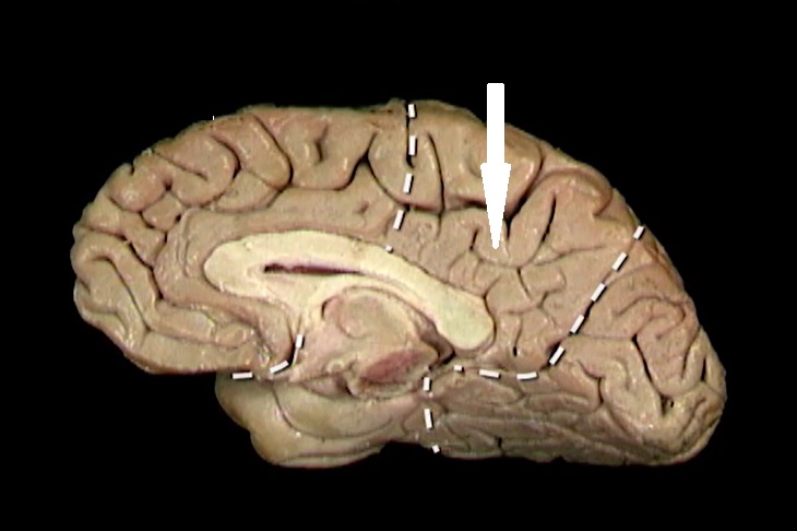 term image