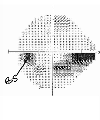<p>What kind of defect is this</p>