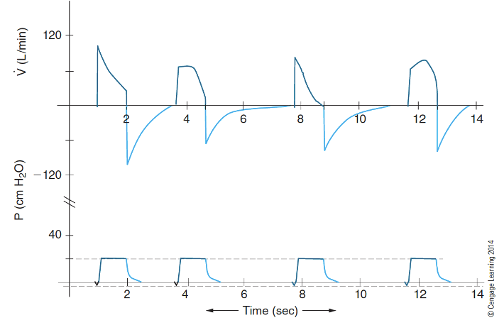 <p>How does airway resistance/compliance affect your flow waveforms and the expiratory phase? </p>