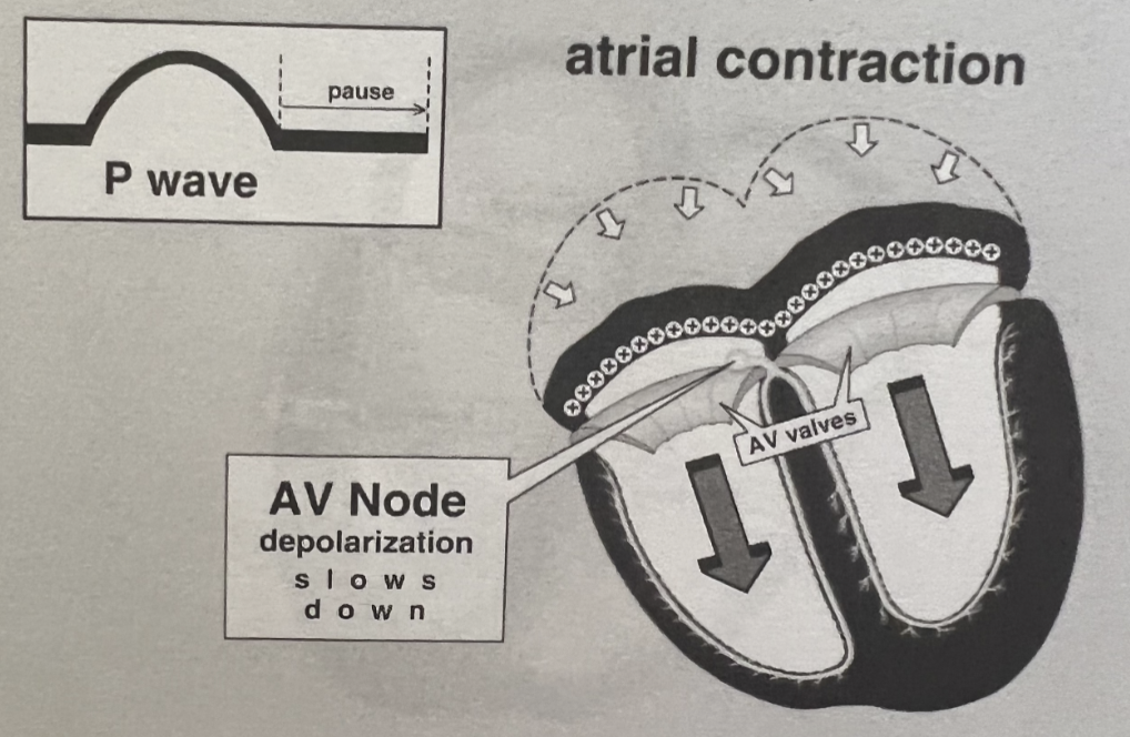 <ul><li><p><span style="color: red;"><strong>Atrial depolarization</strong></span> and conduction through the AV node</p></li><li><p><strong>Normal: 0.12-0.20 sec</strong></p></li></ul><p></p>