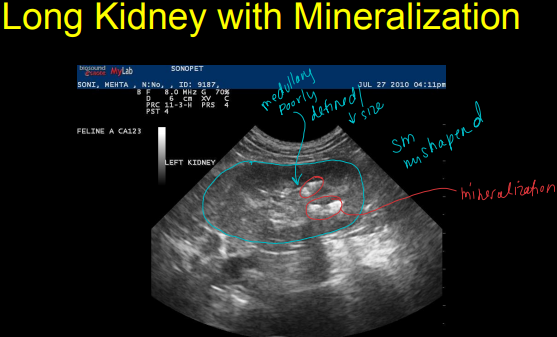 <ul><li><p><strong>Benign</strong></p><ul><li><p><strong>Calculi</strong></p><ul><li><p>pelvic calculi</p></li><li><p><u>dystrophic mineralization of diverticuli</u></p></li></ul></li><li><p><strong><u>Chronic renal disease</u></strong></p><ul><li><p><u>“old cat kidneys</u></p></li></ul></li><li><p><strong>Obstructive renal disease</strong></p><ul><li><p><u>Ureterolith(s)</u></p></li><li><p><u>Transitional cell carcinoma in bladder, </u>prostate or urethra</p></li><li><p>Severe prostatic disease</p></li><li><p>Chronic ureteral stricture</p></li></ul></li><li><p><u>Cortical infarction</u></p></li><li><p><u>Ethylene glycol toxicity</u></p></li><li><p><u>Pyelonephritis</u></p></li><li><p><u>Feline Polycystic Renal disease</u></p></li><li><p><u>Perinephric pseudocyst</u></p></li></ul></li><li><p><strong>Malignant</strong></p><ul><li><p><u>Primary adenocarcinoma</u></p></li><li><p>Metastatic renal disease</p></li><li><p>Lymphosarcoma</p></li></ul></li></ul><p></p>