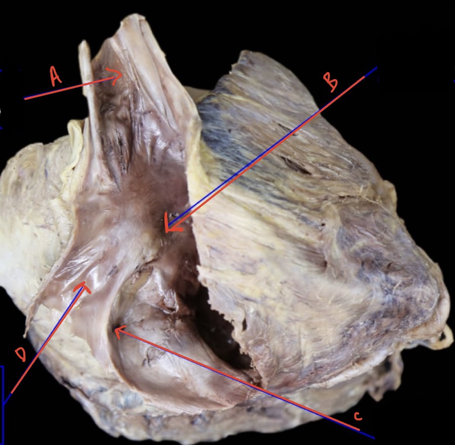 Right atrium internal anterolateral 