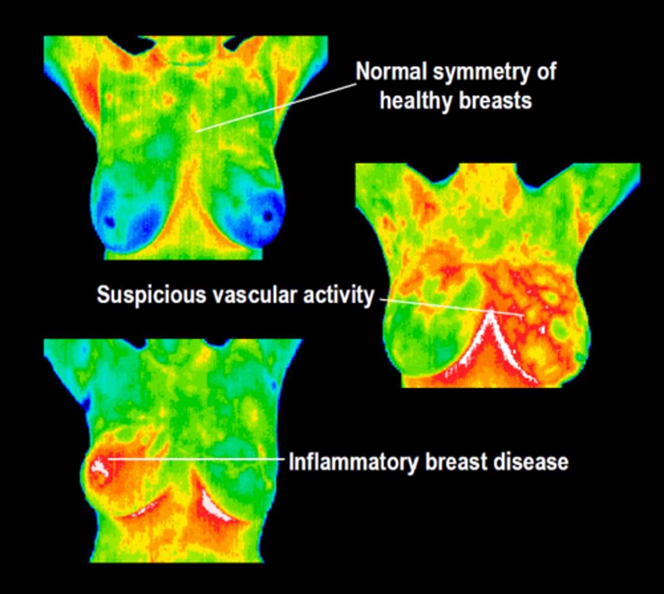 <p>thermography</p>