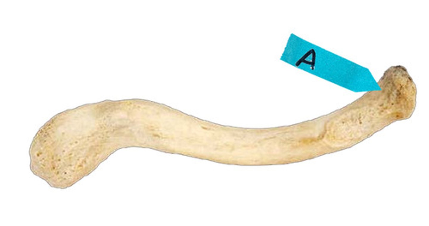 <p>Identify this bone marking.</p>