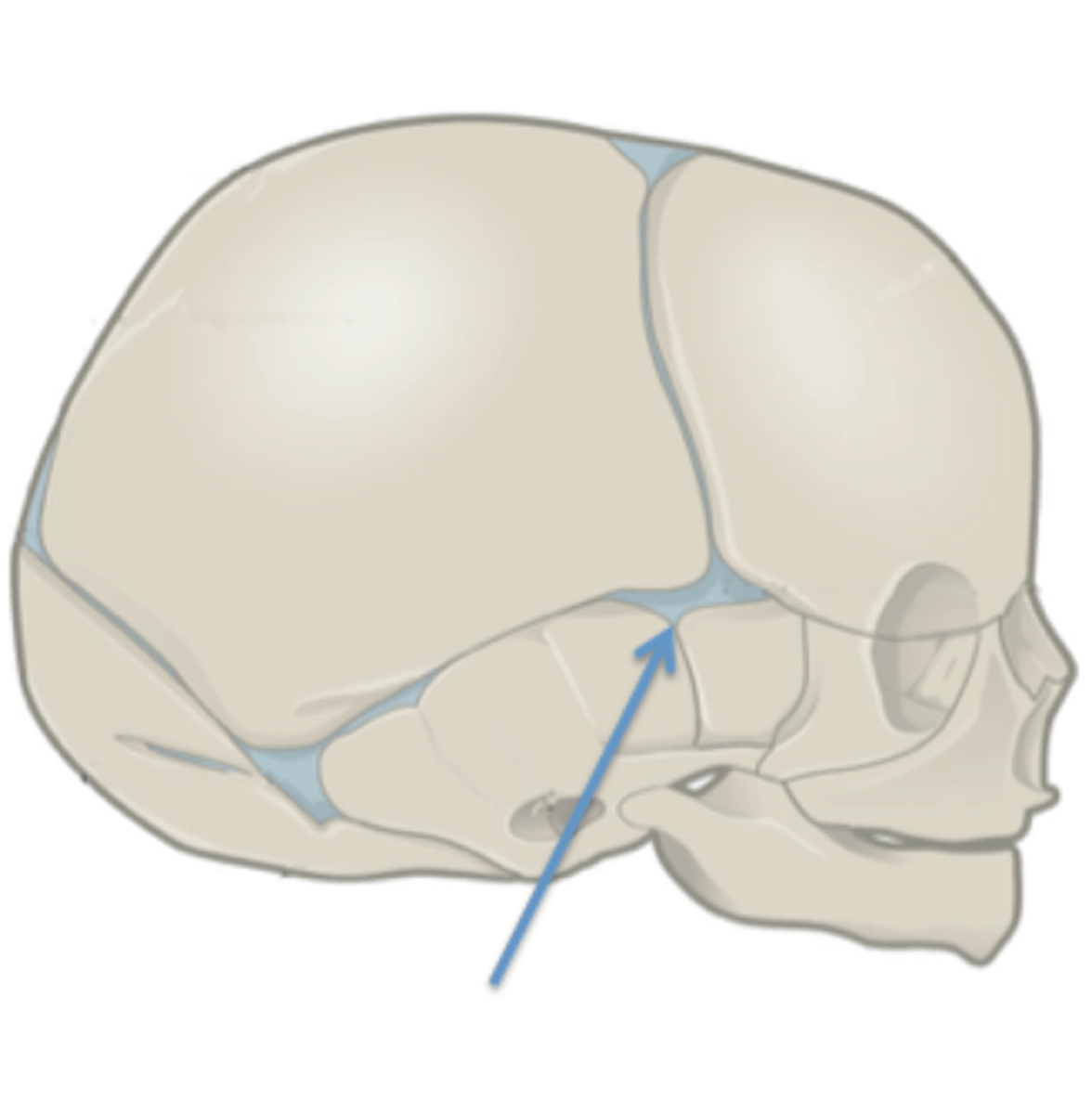 <p>Identify this fetal skull structure.</p>