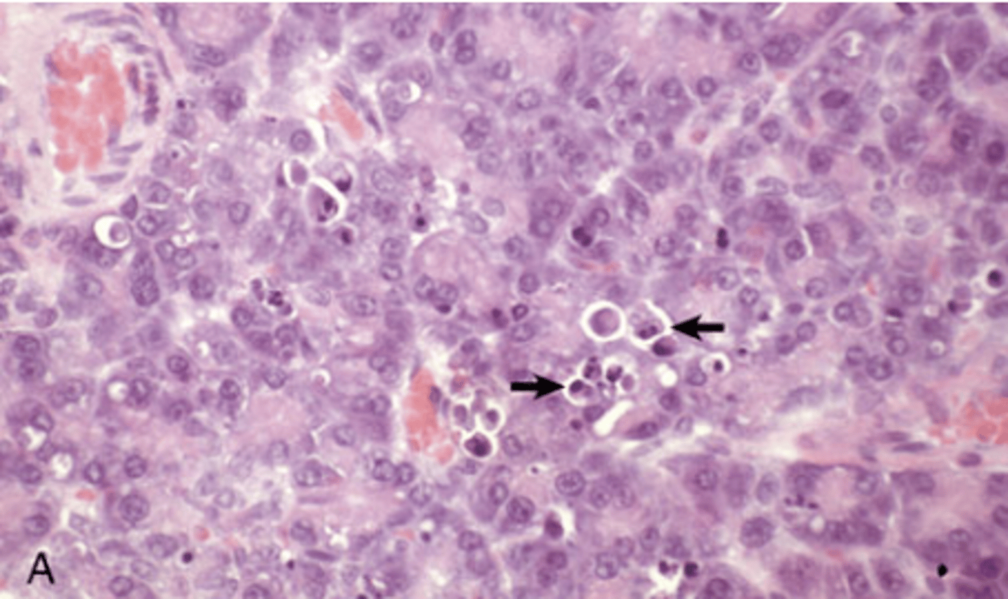 <p>What type of cell death is being shown in this image? Necrosis or apoptosis?</p>