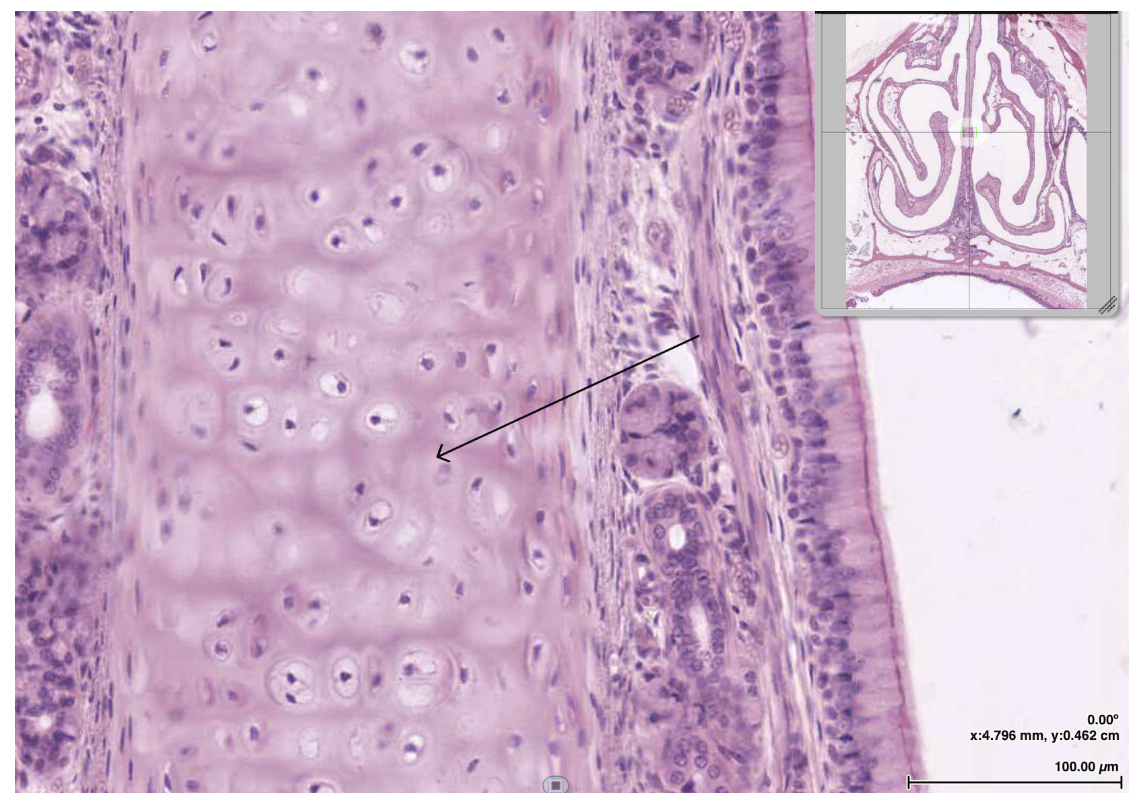<p><span><span>The tissue indicated by the arrow would most likely be found in which other location?</span></span></p>