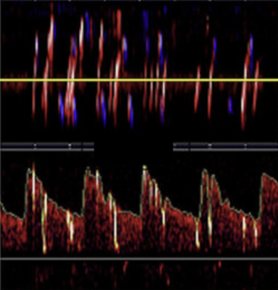 <p>> 10 hits without curtain effect</p>