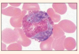 <p>Identify the blood cell</p>