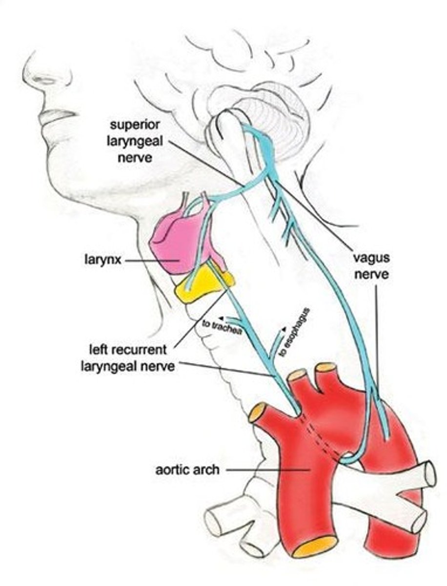 <p>Damage to the recurrent branch of cranial nerve X (CN X).</p>