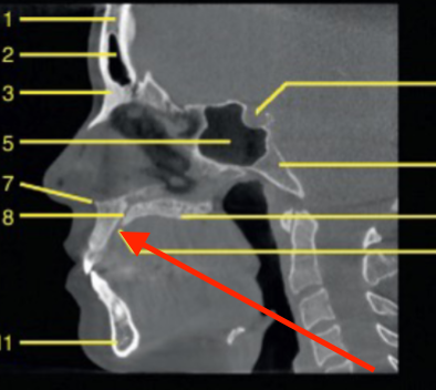 <p>identify the structure</p>