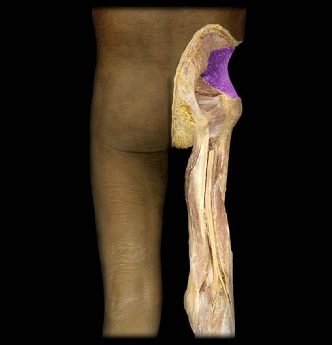 <p>Name This Muscle</p>