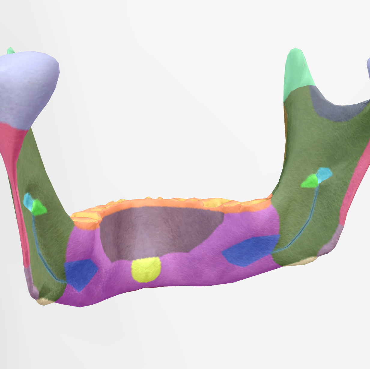 <p>hole on the inner face of the ramus of the mandible </p>