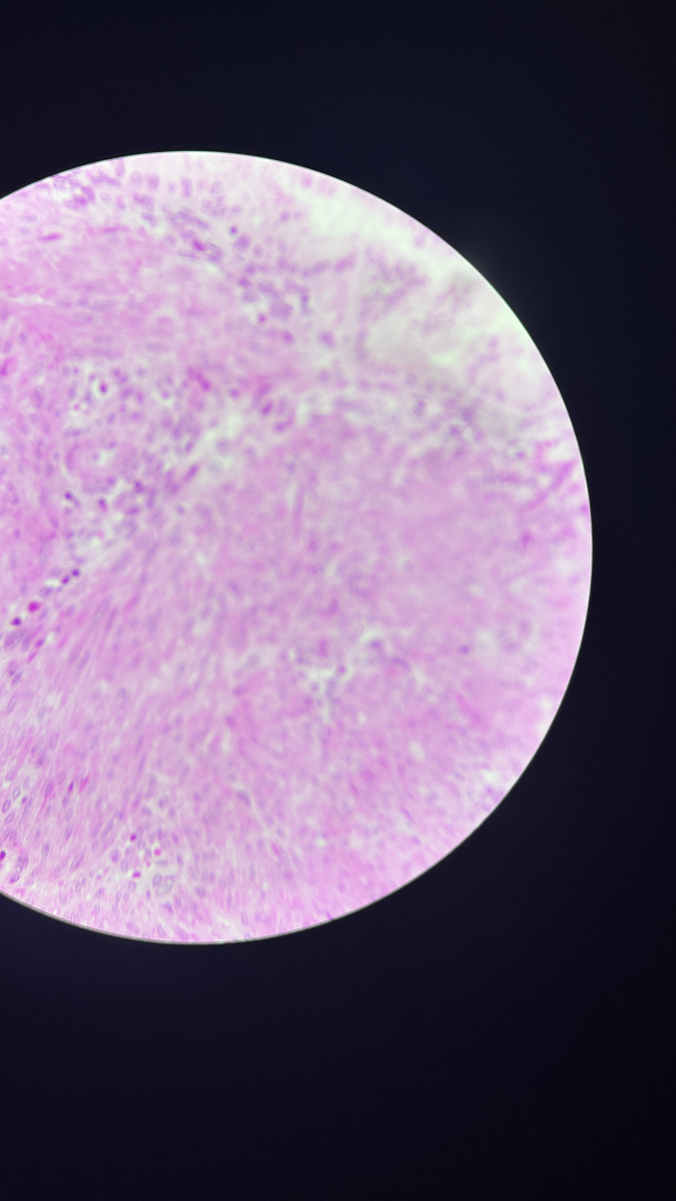 <p>What is the magnification level of the Smooth Muscle?</p>