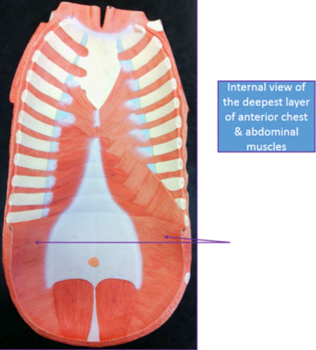 <p>Identify this muscle.</p>
