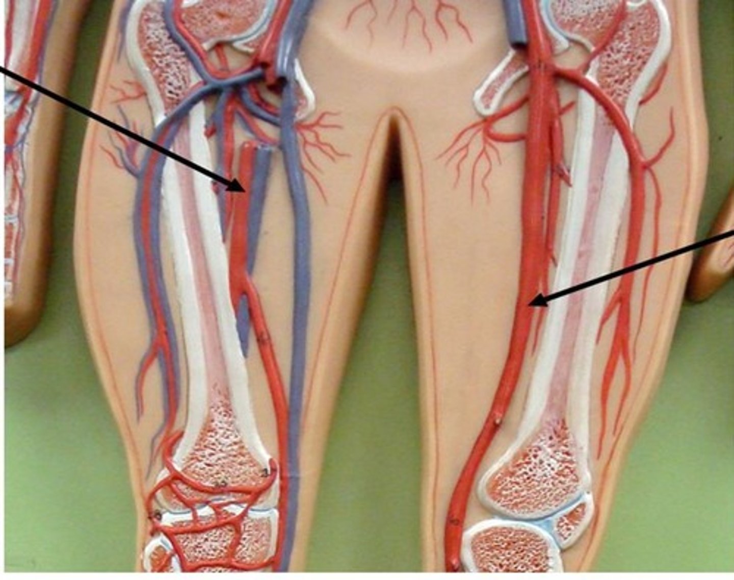 <p>Name the blood vessel.</p>