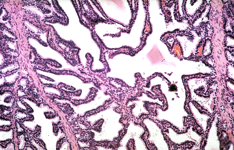 <p>Seminal vesicle</p>