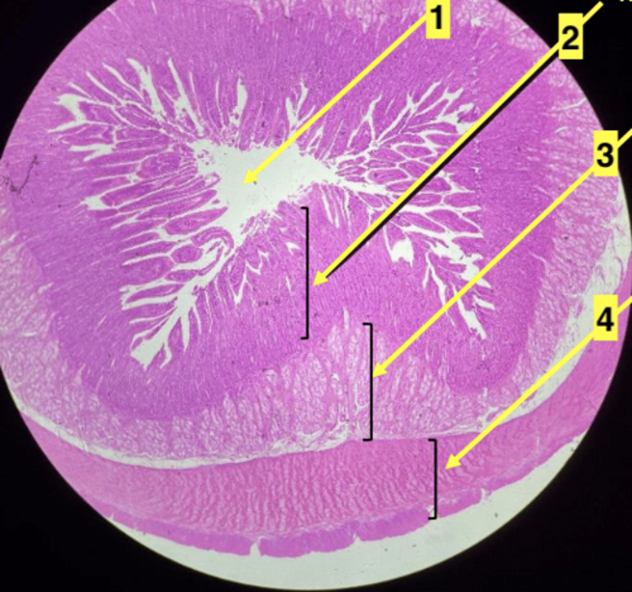<p>lymphatic tissue 2</p>