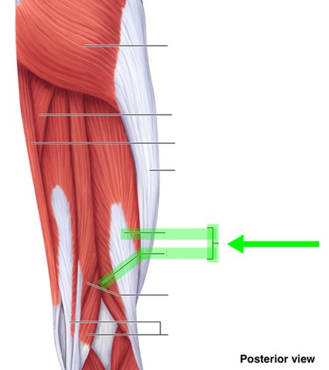 <p>What muscle is this?</p>