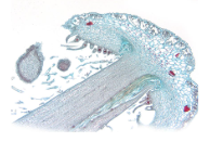 <p>Which division does this Archegonial Head belong to?</p>